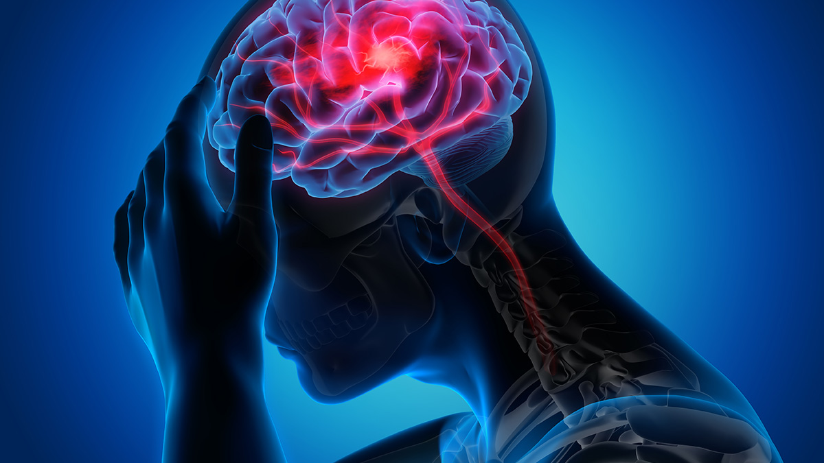 Stroke in Uganda